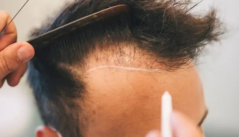 Transformation du duvet en cheveux terminaux : guide complet sur le cycle de croissance&nbsp;capillaire