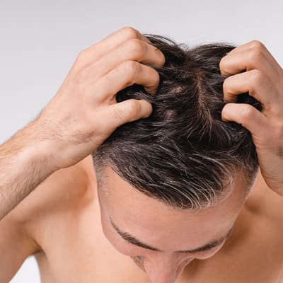 Picotement du cuir chevelu et perte de cheveux : Y&rsquo;a-t-il un lien&nbsp;?